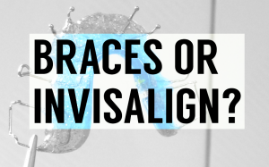braces or invisalign